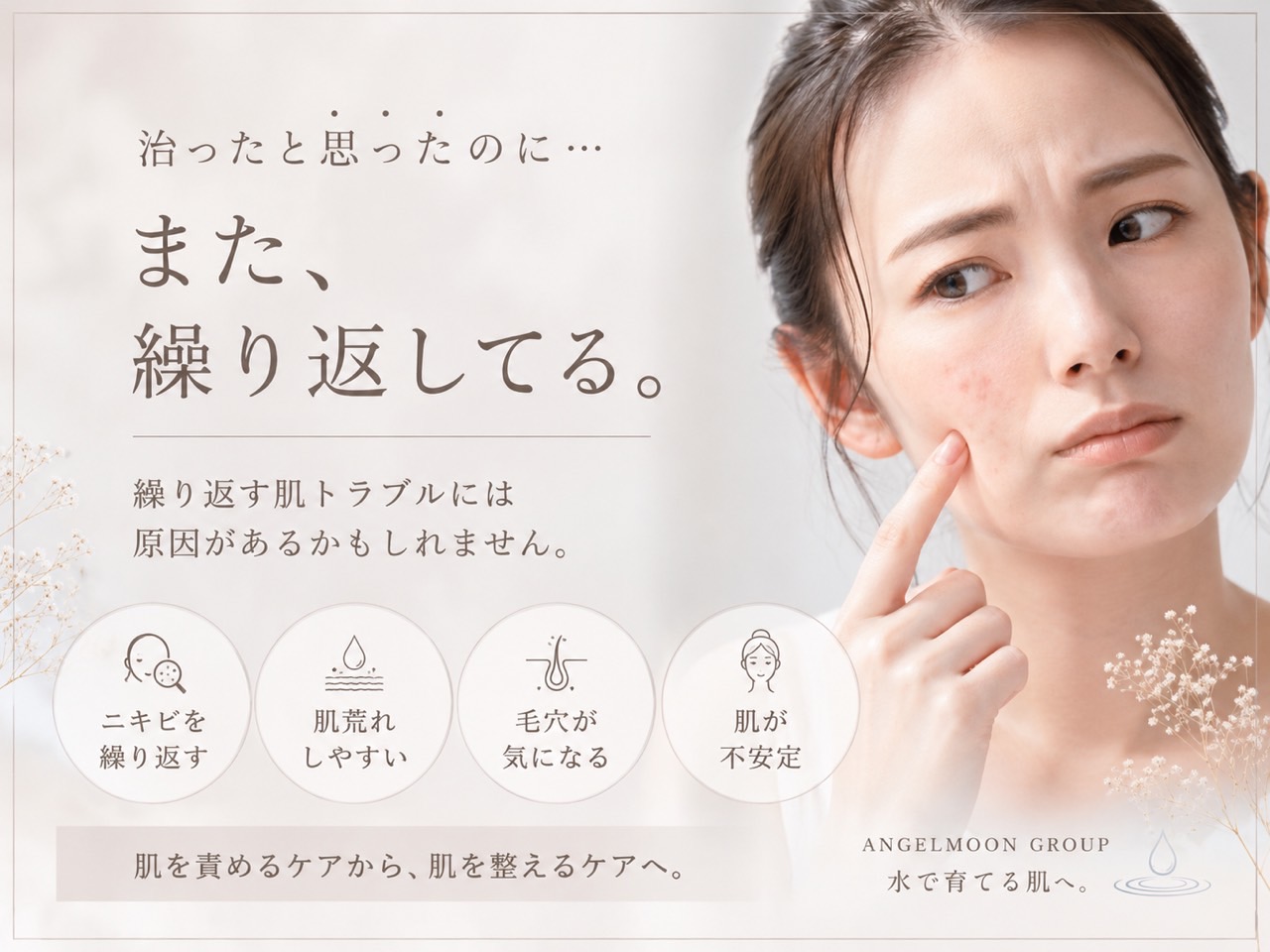 同じ場所に繰り返すニキビや肌荒れに悩む方へ今日の肌を見ながら整えるケアを伝えるSunflower（サンフラワー）の記事画像